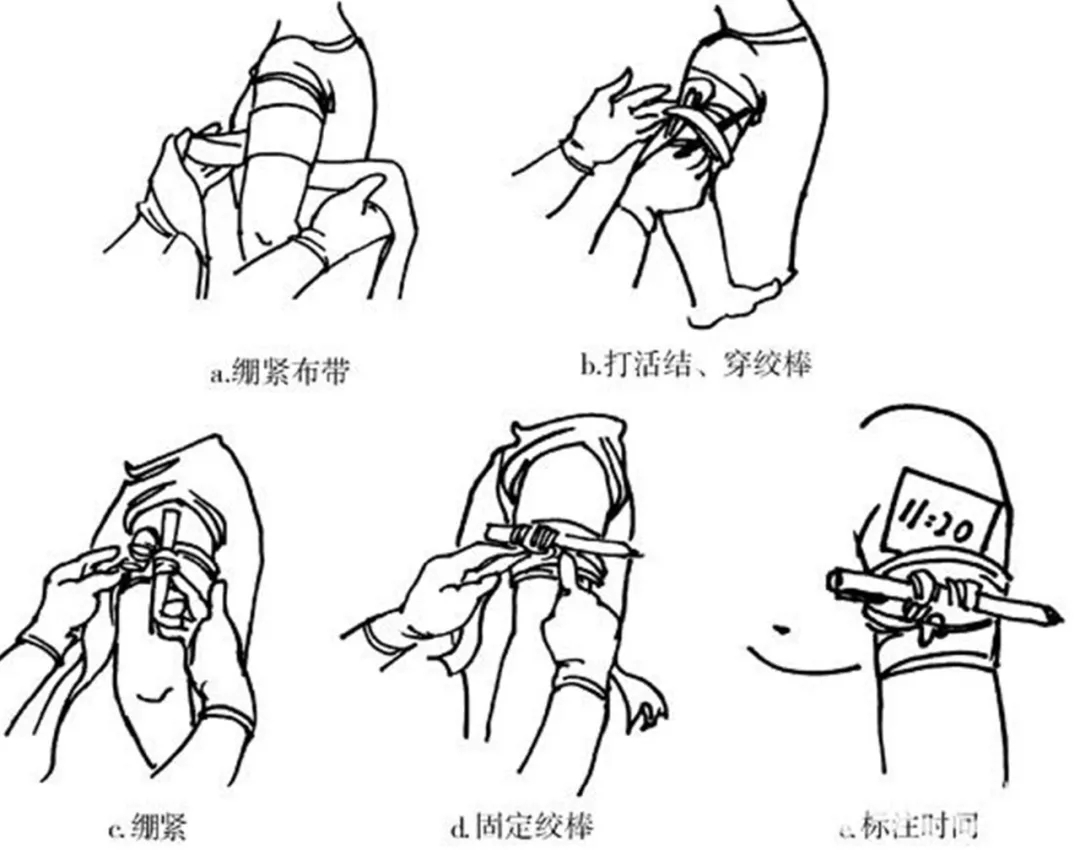 总医院青年志愿服务在行动家庭急救小常识走进身边